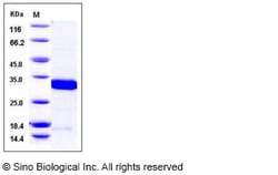 Sino Biological Mouse 14-3-3 sigma / Stratifin / YWHAS Protein 100ug, Quantity: