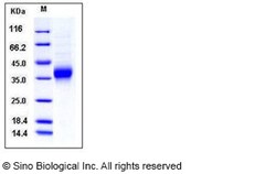 Sino Biological Recombinant Mouse Ephrin A2/EFNA2 Protein (His Tag), Quantity: