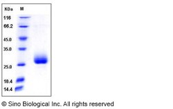 Sino Biological Mouse Ephrin-A2 / EFNA2 Protein 200ug, Quantity: Each of