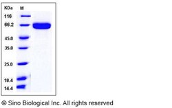 Sino Biological Recombinant Mouse EphA2 Protein (His Tag), HPLC-verified,