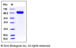 Sino Biological Mouse EphA7 / EHK-3 Protein (His Tag) 200ug, Quantity: