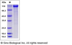 Sino Biological Recombinant Mouse beta-Catenin Protein (His & GST Tag),