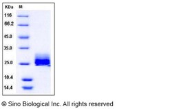 Sino Biological Recombinant Mouse Ephrin-A1 Protein (His Tag), Quantity:
