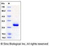 Sino Biological Mouse Ephrin-A5 / EFNA5 Protein (His Tag) 100ug, Quantity: