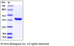 Sino Biological Mouse Epiregulin / EREG Protein (Fc Tag) 100ug, Quantity:
