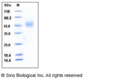 Sino Biological Mouse NEGR1 Protein (His Tag) 100ug, Quantity: Each of