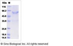 Sino Biological Recombinant Mouse METRN Protein (hFc Tag), Quantity: Each