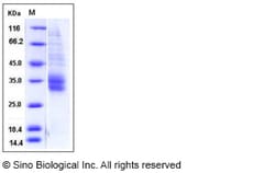 Sino Biological Mouse SLAMF8 / BLAME Protein (His Tag) 100ug, Quantity: