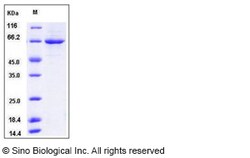 Sino Biological Mouse PLK1 / PLK-1 Protein (His Tag) 50ug, Quantity: Each