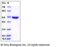 Sino Biological Mouse SerpinB10 Protein (His Tag) 100ug, Quantity: Each