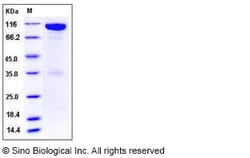Sino Biological Recombinant Mouse EphA6 Protein (hFc Tag), Quantity: Each