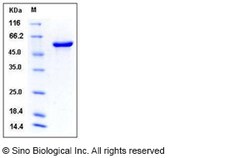 Sino Biological Mouse P4HB / ERBA2L Protein (His Tag) 100ug, Quantity: