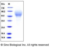 Sino Biological Recombinant Mouse CD200R4 Protein (His Tag), Quantity: