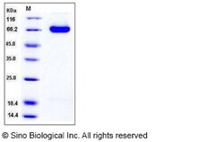 Sino Biological Mouse DLL4 / Delta4 Protein (His Tag) 100ug, Quantity: