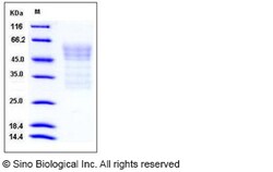 Sino Biological Mouse Syndecan-1 / SDC1 / CD138 Protein (His Tag) 100ug,
