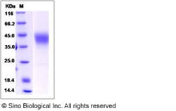 Sino Biological Mouse ICAM-2 / CD102 Protein 100ug, Quantity: Each of 1