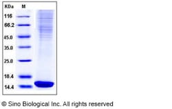 Sino Biological Recombinant Mouse FABP4/A-FABP Protein (His Tag), Quantity: