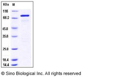 Sino Biological Recombinant Mouse GAD65/GAD2 Protein (His & GST Tag), Quantity: