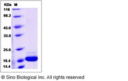 Sino Biological Mouse IFNA14 / Interferon alpha-14 Protein (His Tag) 100ug,