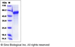 Sino Biological Mouse Noggin / NOG Protein (Fc Tag) 1mg, Quantity: Each