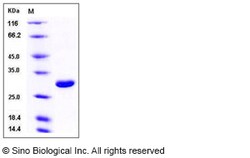 Sino Biological Recombinant Mouse UCHL1 Protein (His Tag), Quantity: Each