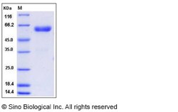 Sino Biological Mouse CHODL / Chondrolectin Protein (Fc Tag) 100ug, Quantity: