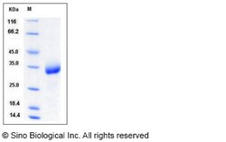 Sino Biological Recombinant Mouse CHODL Protein (His Tag), Quantity: Each