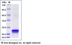 Sino Biological Recombinant Mouse CLEC3A Protein (His Tag), Quantity: Each