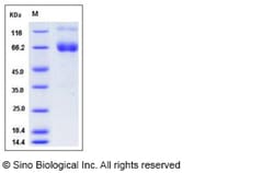 Sino Biological Recombinant Mouse IFNGR1 Protein (hFc Tag), Quantity: Each