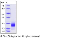 Sino Biological Recombinant Mouse CD302 Protein (His Tag), Quantity: Each