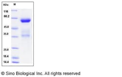 Sino Biological Recombinant Mouse CLEC10A/CD301 Protein (hFc Tag), Quantity: