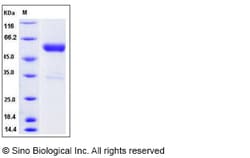 Sino Biological Recombinant Mouse IFN-beta Protein (hFc Tag), Quantity: