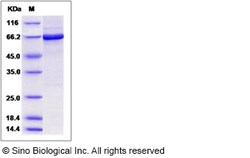 Sino Biological Recombinant Mouse Brk Protein (His & GST Tag), Quantity: