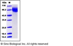 Sino Biological Recombinant Mouse CD6 Protein (His Tag), HPLC-verified,
