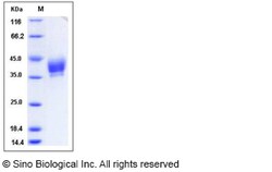 Sino Biological Recombinant Mouse Siglec-3/CD33 Protein (His Tag), HPLC-verified,