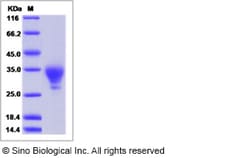 Sino Biological Mouse WAP5 / WFDC2 / HE4 Protein (His Tag) 50ug, Quantity: