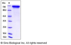 Sino Biological Recombinant Mouse Neuroligin 1 Protein (His Tag), Quantity: