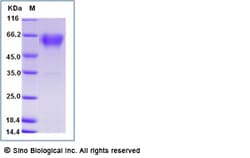 Sino Biological Mouse CD68 Protein (His Tag) 100ug, Quantity: Each of 1