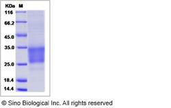 Sino Biological Recombinant Mouse CD69 Protein (ECD, His Tag), Quantity: