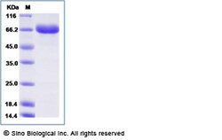 Sino Biological Mouse E-Selectin / CD62e / SELE Protein 20ug, Quantity:
