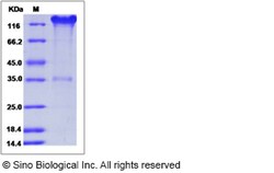 Sino Biological Mouse SELP / selectin P / P-selectin Protein (Fc Tag) 100ug,
