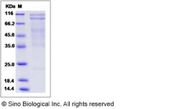 Sino Biological Mouse N-Cadherin / CD325 / CDH2 Protein 100ug, Quantity: