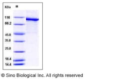 Sino Biological Mouse PARP-1 / PARP Protein (His Tag) 100ug, Quantity: