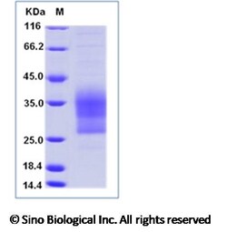 Sino Biological Mouse CD79B / B29 Protein (His Tag) 50ug, Quantity: Each