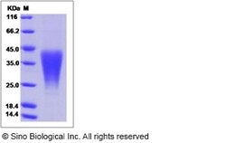 Sino Biological Mouse LIF Protein 20ug, Quantity: Each of 1