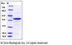 Sino Biological Recombinant Mouse Carbonic Anhydrase 8/CA8 Protein (His