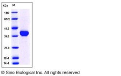 Sino Biological Recombinant Mouse Carbonic Anhydrase X Protein (His Tag),