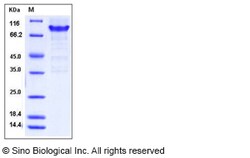 Sino Biological Mouse PSGL-1 / CD162 / SELPLG Protein (Fc Tag) 100ug, Quantity: