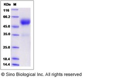 Sino Biological Mouse Frizzled-5 / FZD5 Protein (Fc Tag) 100ug, Quantity: