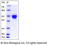 Sino Biological Mouse STHM / ST6GALNAC2 Protein (His Tag) 50ug, Quantity:
